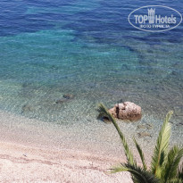 фото из отзыва ID 1300035