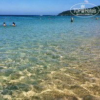 фото из отзыва ID 1335304