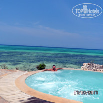 фото из отзыва ID 1577001