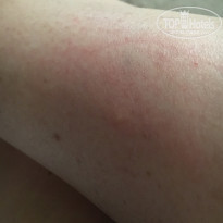 фото из отзыва ID 1583649