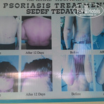 фото из отзыва ID 1688574