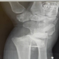 фото из отзыва ID 2651631