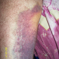 фото из отзыва ID 380547