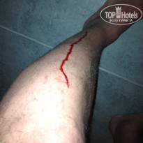 фото из отзыва ID 644471