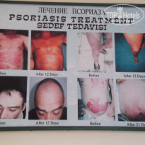 фото из отзыва ID 651118