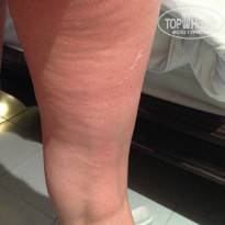 фото из отзыва ID 914060