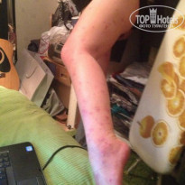 фото из отзыва ID 914722