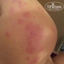 фото из отзыва ID 930171