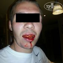 фото из отзыва ID 992625