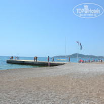 фото из отзыва ID 993719